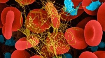 Pıhtılaşma Sistemi